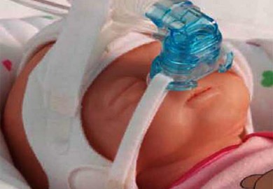 Engineering of medical device